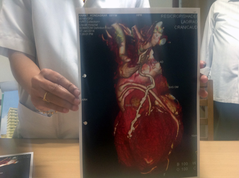 Long Term results  - follow up more than 10 years